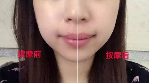医美过度的明星网红,网红明星过度整形背后的真相