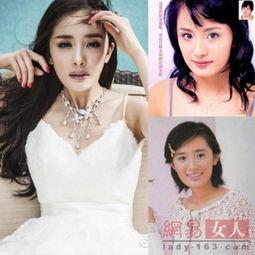 明星网红整形事故图片,揭秘美丽背后的风险与代价