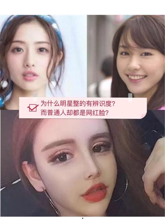 明星网红的整容过程图解,从素颜到蜕变