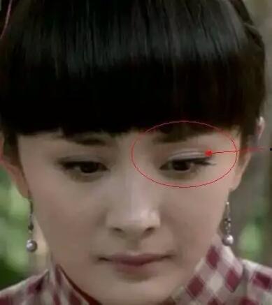 明星网红贴双眼皮,明星同款眼眸养成记